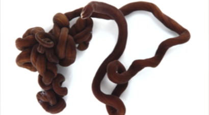 Dünyanın 55 Metrelik En Uzun Hayvanı Zehirli Çıktı