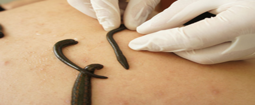 Tıbbi Sülük İhracatında Yeni Karar