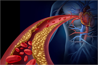 Vücutta yüksek kolesterol görülmesine neden olmaktadır Kolesterol seviyesinin yükselmesiyle ciddi metabolik rahatsızlıklar da görülmektedir