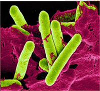 Bilinçsiz hazırlanan konserveler ölümcül bir zehirlenme türü olan botulismus hastalığına neden olabiliyor