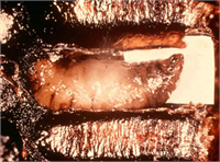 Torba Hastalığı Bu hastalık daha çok kışı kötü koşullar içinde geçirerek bahara zayıf çıkan bakımsız kovanlarda pupa halindeki yavrularda görülür Diğer yavru hastalıkları kadar tehlikeli değildir Kurtçuklar içi su dolu torba gibi yanından bir tığ ile tutulursa kolaylıkla dışarı çıkarılabilir