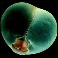 19 Pigbutt solucanı Bu havyanın domuz poposunu andıran şekli sebebiyle ismi Pigbutt konulmuştur Okyanus yüzeyinin yaklaşık 1 km altında yaşarlar