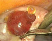 Zeytin yumurtalıkların sağlığı ve fonksiyonlarının yerine getirilmesinde önemli rol oynar