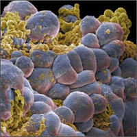 Brüksel lahanası lif vitamin C betacarotene vitamin A ve azotça zengindir Bunlar kanser riskinin önlenmesine yardımcı olurlar Brokoli de kansere karşı iyi geliyor