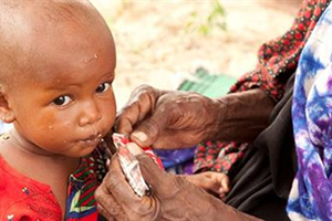 Dünya Nüfusunun 12 9 Yetersiz Besleniyor