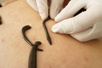 Tıbbi Sülük İhracatında Yeni Karar